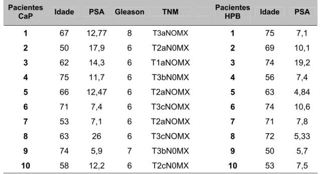 TABELA I - Parâmetros clínicos e laboratoriais dos pacientes com CaP  e HPB utilizados  para a extração de proteínas totais.