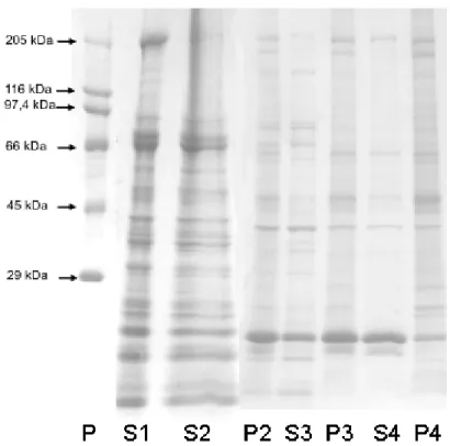 Figura 1: Perfil de polipeptídios das frações S1, S2, P2, S3, P3, S4 e  P4 de larva de Pachymerus nucleorum