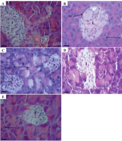 Figure 2. Photomicrographs of pancreatic islets of Langerhans from normal control mice treated with saline (A), and diabetic mice treated with saline (diabetic control; B), protein fraction (C), fat fraction (D), or glibenclamide (E) for 30 days.