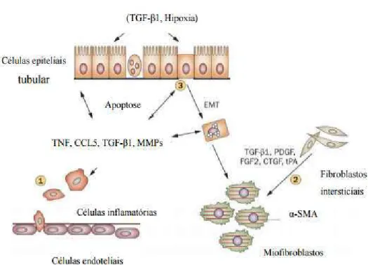 Figura 3: Principais eventos da fibrogênese renal: (1) Infiltrado peritubular das células inflamatórias,  principalmente,  células  T  e  macrófagos,  sendo  o  evento  inicial  da  fibrogênese