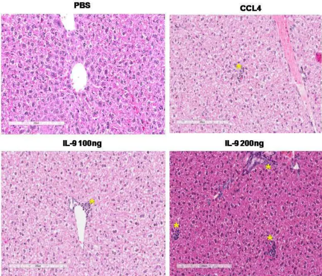 Figura  7:  Fotomicrografias,  dados  apresentados  na  tabela1,  referentes  a  regiões  típicas  e  representativas dos cortes histológicos, corados com hematoxilina e eosina, provenientes do tecido  hepático  dos  camundongos  tratados  com  PBS,  CCL 4