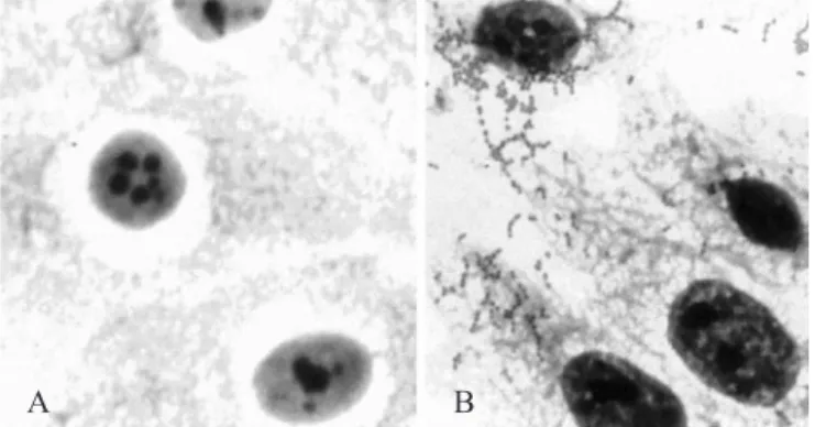 Figure 2. Adhesion to HEp-2 cells. (A) HEp-2 cells, control, (B) E. faecalis adhered to HEp-2 cells