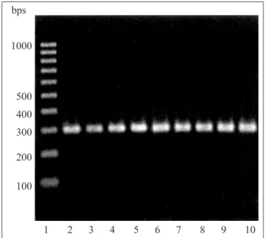 Figure 2. The gel image of amplification of C. dubliniensis specific gene in cytochrome b