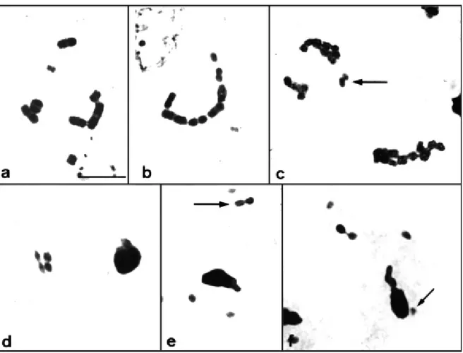 Figure 3 - Conventional staining shows sequential changes in the harlequin follicle abnormalities in the Antiteuchus species studied: (a) initial diakinesis, some autosomal bivalents become associated through thin chromatin bridges; (b) all autosomal bival