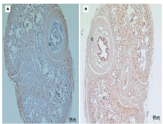Figure 3. Mean ( ± standard error) of endothelin A (ET A ) and B (ET B ) expression in cavernous tissue samples of the groups studied.