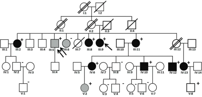 Figure 1. Family pedigree. The arrow indicates the index case. The double arrow indicates the patient who donated a kidney and still had an estimated glomerular ﬁ ltration rate (eGFR) of 66 mL  min -1 /(1.73m 2 ) at age 59