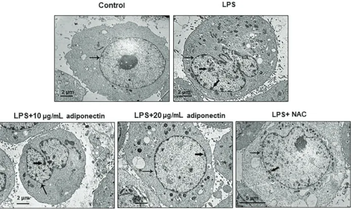Figure 4. Electron micrographs of human umbilical vein endothelial cells (HUVECs) in each group