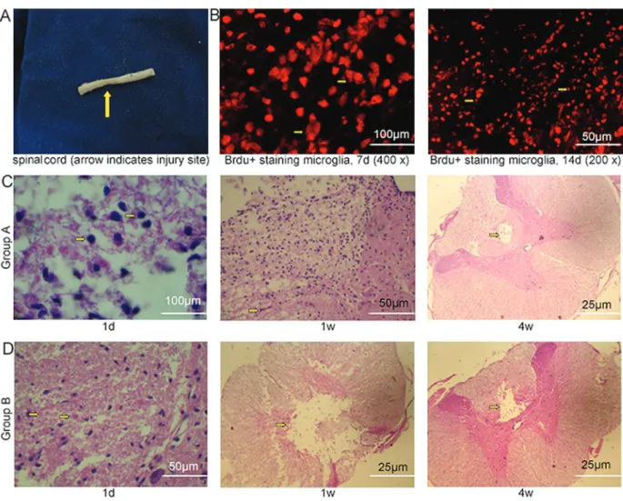 Figure 4. Tracing of transplanted microglial cells and histological staining of the injured spinal cord