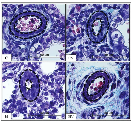 Table 2. Mean wall thickness (MWT) of preacinar arterioles with diameter of 30 – 60 mm.
