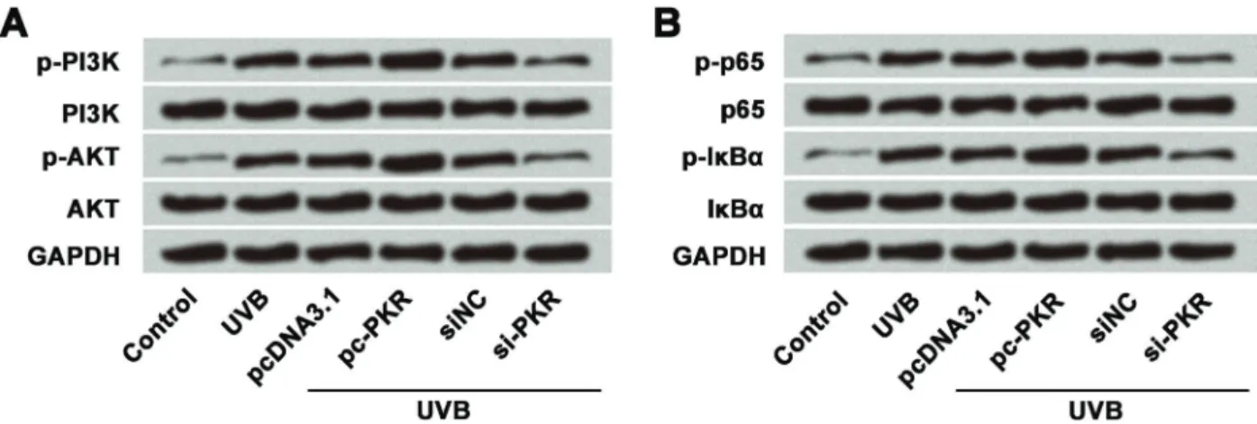 Figure 7. Western blotting analysis of PKR on PI3K/AKT and NF-kB signaling pathways, which suggested that overexpression of PKR activated A, PI3K/AKT pathway and B, NF-kB pathway