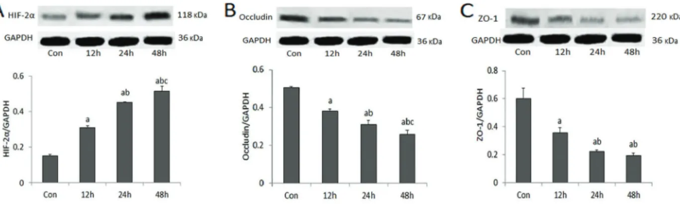 Table 1. Expression of HIF-2a, occludin, and ZO-1 in different groups.