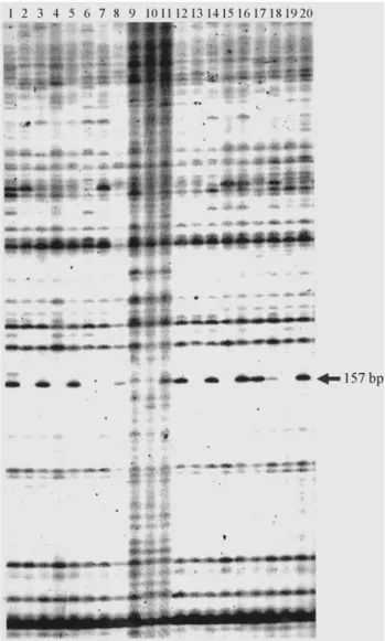 Figure 1 - MFLP fingerprinting on 20 RILs derived from a domesticated x wild cross in Lupinus angustifolius generated by SSR-anchor primer MF51 in combination with primer MseI-CGA