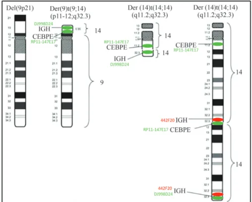 Figure 2 - Ideograms of abnormal chromosomes 9 and 14 involved in the t(9;14;14), with the localization of the IGH and CEBPE genes labeled by three BACs - 442F20 (red), J998D24 (green) and RP11-147E17 (green) - used as probes in FISH experiments.