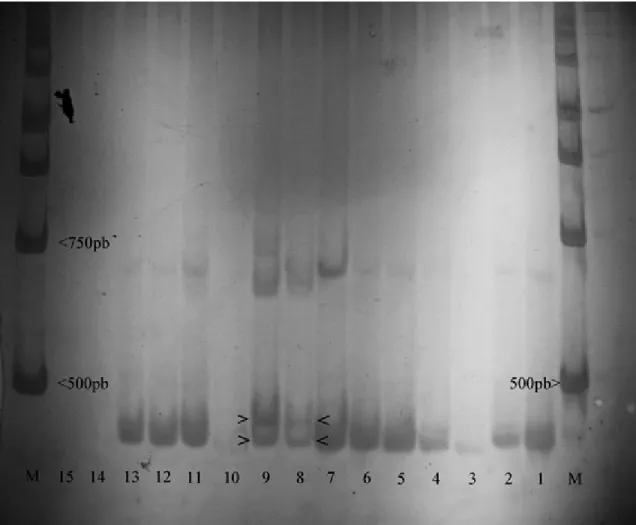 Figure 1 - Polyacrylamide gel photo showing the differences in migration patterns of bands of European and Brazilian populations of D