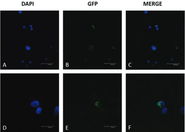 Figure 4 - Localization of recombinant MEFV proteins in untreated HL-60 cells. MEFV-fl-GFP and MEFV-d2-GFP constructs were transfected via Nucleofection and the localization of their products was analyzed using confocal microscopy
