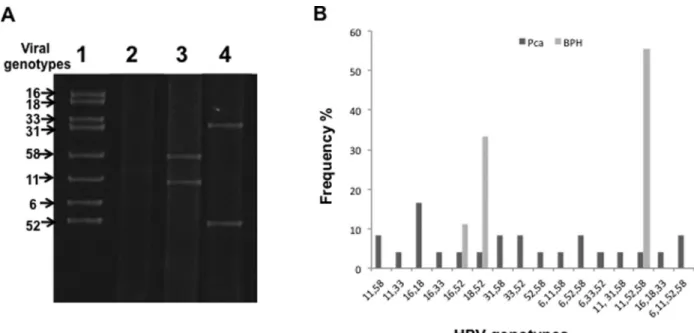 Figure 1 - HPV genotypes detected in this study. (A) Electrophoresis of PCR products. Lane 1: positive control (HPV genotypes detected), lane 2: nega- nega-tive control (no added DNA), lanes 3 and 4: representanega-tive samples