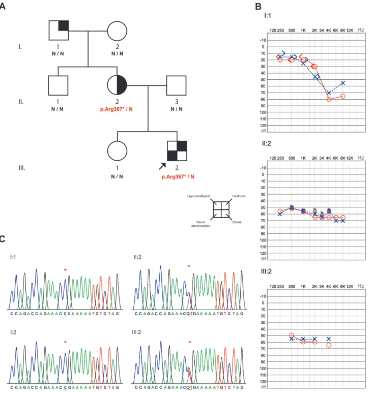 Figure 1 - Results of the analyzed family. A) Pedigree of the studied family with the genetic screening for the p.Arg367* mutation in the GATA3 gene.