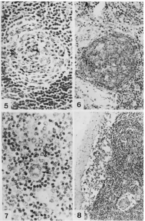Fig. 5: follicular involution. Atrophic follicle presenting only FDCs and  few small lymphocytes (PAMS X 500)