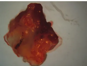 Fig. 2 shows an increase in fungal density (in a loga- loga-rithmic scale of vegetations) in rats infected 24 h and  five days after inoculation, with a vegetations average of  3.89 CFU/g tissue at 24 h and an average of 5.08 CFU/g  tissue (p &lt; 0.05) at