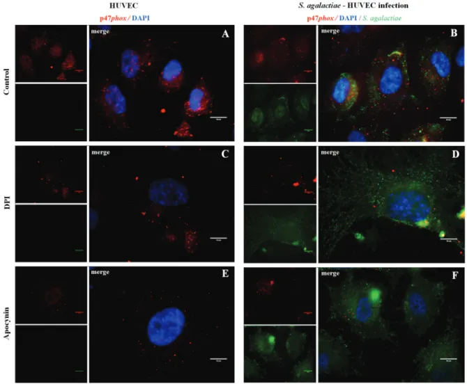 Fig. 2: immunofluorescence assays of NADPH oxidase p47phox subunit activity during infection of human primary endothelial cells (HU- (HU-VECs) by Streptococcus agalactiae