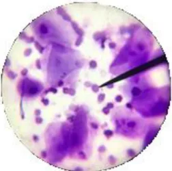 Figura 1 – Citologia auricular com formas  de Malassezia sp.  em grande quantidade. 