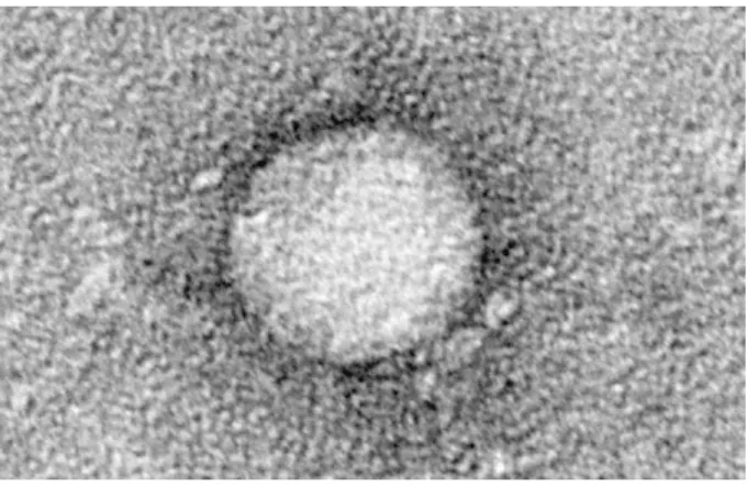 Figura 1 Vírus da hepatite C em microscopia eletrônica de varredura.  