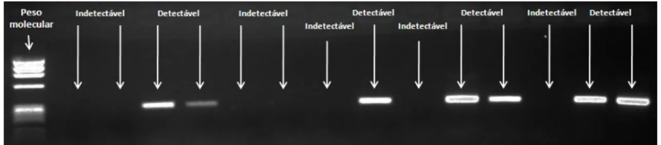 Figura 5 Visualização de “bandas” do produto da PCR em gel de agarose observado em luz ultra-violeta.
