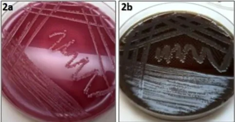 Figura  2:  Crescimento  bacteriano  de  amostras  de  cadelas  com  piometra  em  Uberlândia