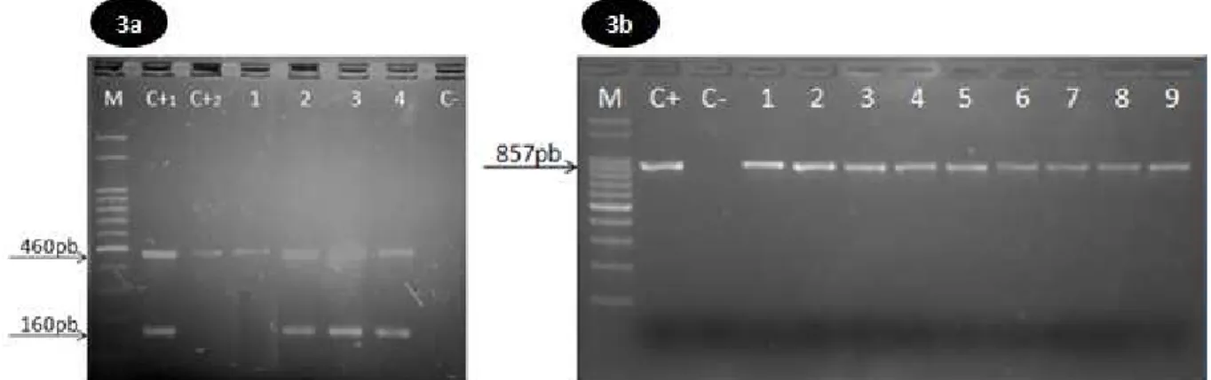 Figura  3:  3a-  PCR-multiplex  para  identificação  de  Campylobacter  jejuni  e  C.  coli  em  amostras  de  carcaças  de  frangos