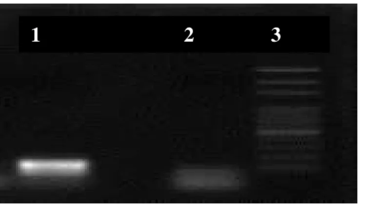 Figura 6: Imagem da amplificação do gene do M. leprae em amostra de secreção nasal utilizando os  iniciadores LP1 e LP2