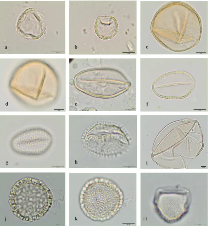 Figure 4. Light microscopy photographs of pollen grains observed in the royal jelly samples