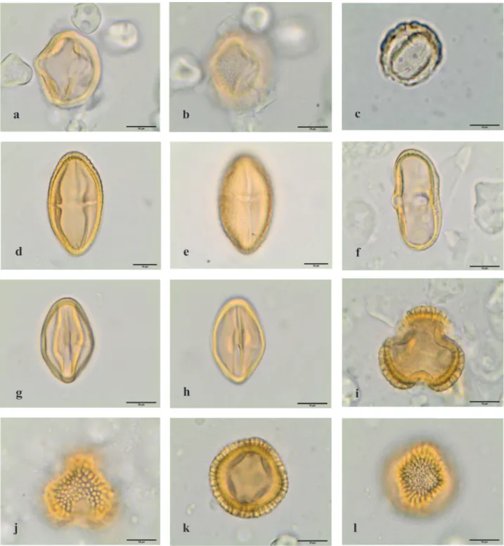Figure 5. Light microscopy photographs of pollen grains observed in the royal jelly samples