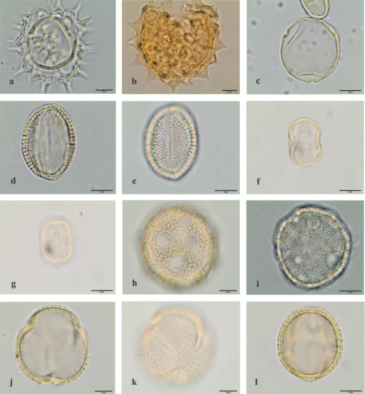 Figure 7. Light microscopy photographs of pollen grains observed in the royal jelly samples