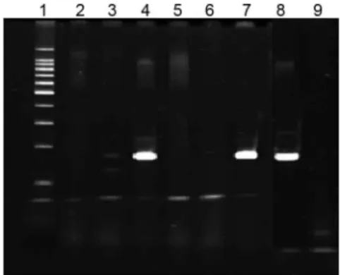 Fig. 2: detection of PCR products of IS6110 in direct BACTEC ®  12B  cultures. Lanes - 1: 100 bp ladder marker; 2: negative control (water); 