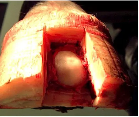 Figure 3 - Spherical keratoma inside the hoof. Adapted from  Greet, 2016 