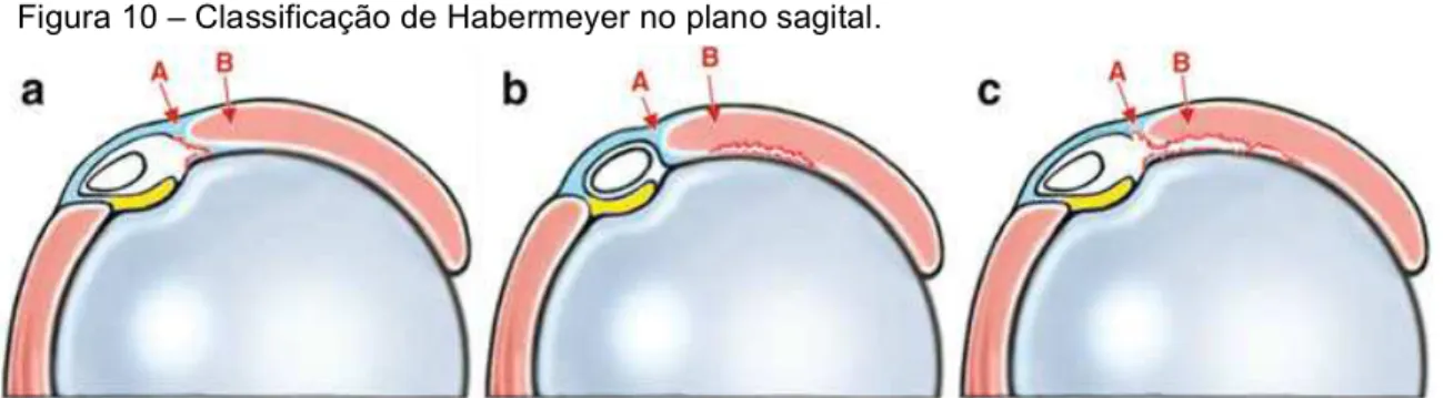 Figura 11: Classificação de Patte.    