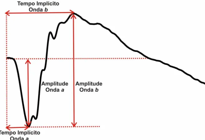 Figura 10. Análise de amplitude e tempo implícito das ondas registradas através do Eletrorretinograma de  Campo Total