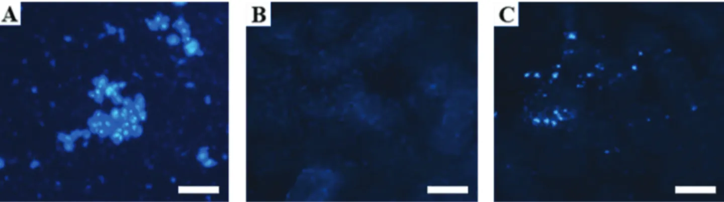 Figure 2 - DAPI staining: (A) MSC stained with DAPI; (B) renal cortex without MSC infiltration; (C) renal cortex with MSC infiltration, 48 h after the transplant