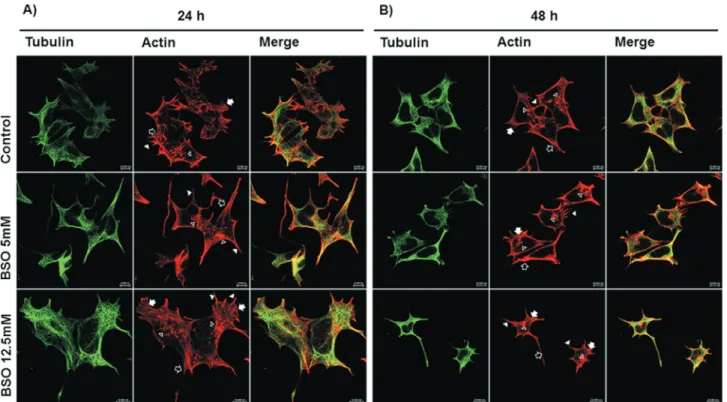 Figure 2 - Comparative morphological changes induced by 24 and 48 h BSO treatments. Confocal microscopy images of MSN cells showing that the 48 h BSO treatments caused more drastic morphological changes compared to the 24 h BSO treatments