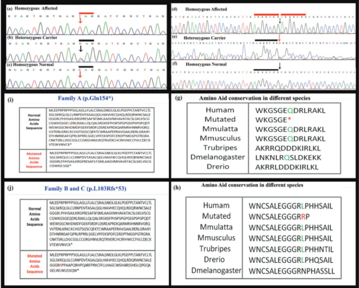 Figure 3 - Sequence analysis of WNT10B gene showing a novel nonsense variant (c.460C &gt; G, p.Gln154*) in affected individuals in family A and B