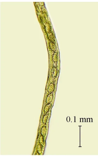 Figure 10. Capillaria tenuissima. Gravid female with eggs visible. 