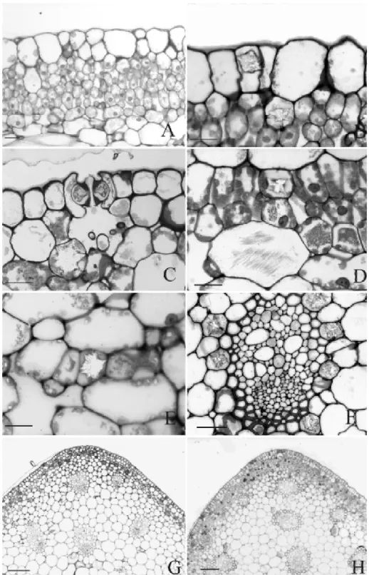 Figure 2 – Leaf mesophyll. Transversal section. A. periclinal divisions in epidermal cells from the adaxial surface.