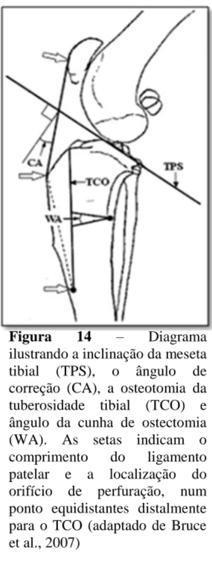 Figura  14  –  Diagrama  ilustrando a inclinação da meseta  tibial  (TPS),  o  ângulo  de  correção  (CA),  a  osteotomia  da  tuberosidade  tibial  (TCO)  e  ângulo  da  cunha  de  ostectomia  (WA)