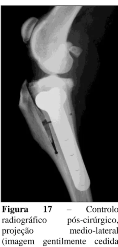 Figura  17  –  Controlo  radiográfico  pós-cirúrgico,  projeção  medio-lateral  (imagem  gentilmente  cedida  pelo Dr