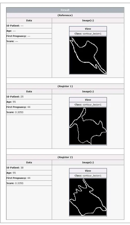 Figura 4.7: Resultado da consulta Query1.