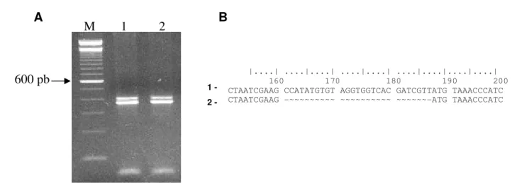 Figura 2: RT-PCR de formas alternativas de MsFAMeT com splicing de um micro-exon de 27nt