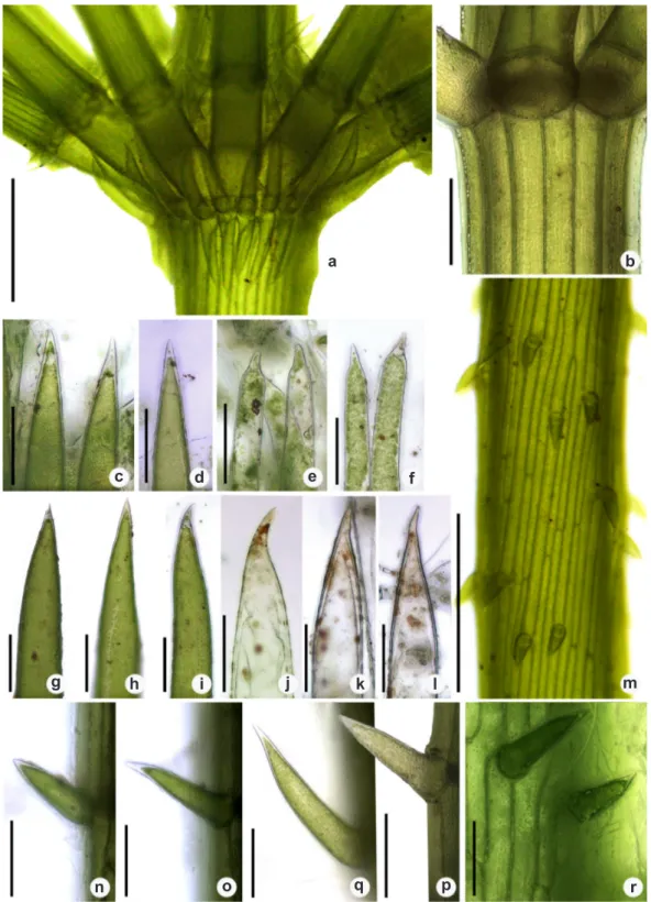 Figura 9 – a-r. Chara kenoyeri – a. detalhe de estipulóides diplostéfanos; b. detalhe do râmulo com córtex diplóstico; c,d