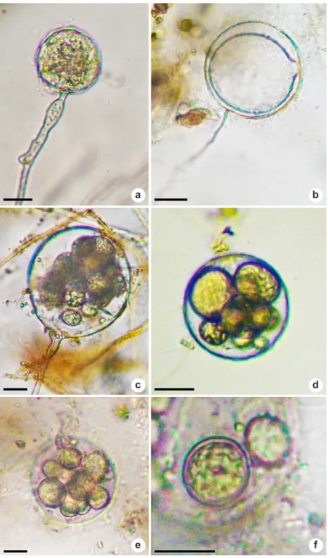 Figura 6 – Estruturas de Olpidiopsis sp2 produzidas em esporos de fungo micorrízico (Glomeromycota) – a