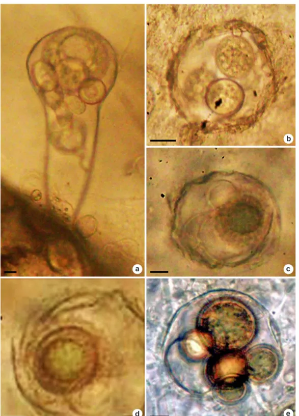 Figura 1 – Estruturas de Olpidiopsis achlyae produzidas em dilatação de hifas de Achlya proliferoides – a