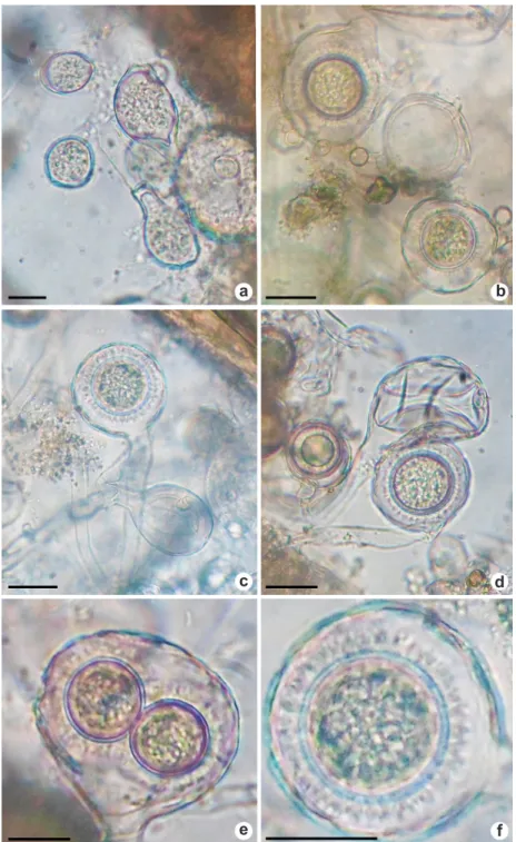 Figura 2 – Estruturas de Olpidiopsis aphanomycis produzidas em dilatação de hifas de Aphanomyces keratinophilus – a